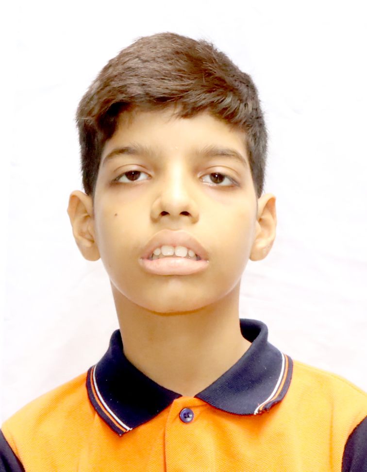 Best School in Surat